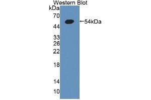 Figure. (GCK antibody  (AA 194-410))