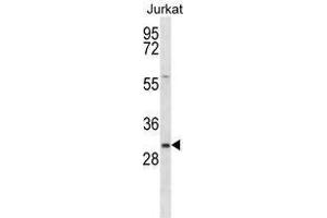 TMED8 Antibody (Center) western blot analysis in Jurkat cell line lysates (35 µg/lane). (TMED8 antibody  (Middle Region))