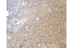 Immunohistochemistry (IHC) image for anti-Forkhead Box O3 (FOXO3) (C-Term) antibody (ABIN185248)