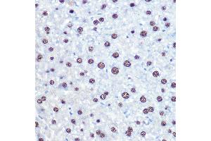 Immunohistochemistry of paraffin-embedded mouse liver using APIP Rabbit pAb (ABIN6131310, ABIN6136985, ABIN6136986 and ABIN6222909) at dilution of 1:100 (40x lens).