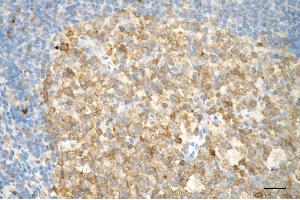 Immunohistochemistry was performed on paraffin-embedded human tonsillitis using caspase 3 antibody (ABIN7797895), 1:200).