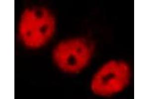 Immunofluorescence (fixed cells) (IF/ICC) image for anti-Nuclear Factor of kappa Light Polypeptide Gene Enhancer in B-Cells Inhibitor, alpha (NFKBIA) (pTyr305) antibody (ABIN6255877)