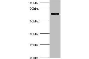 Western blot All lanes: SLC27A6 antibody at 4 μg/mL + MCF-7 whole cell lysate Secondary Goat polyclonal to rabbit IgG at 1/10000 dilution Predicted band size: 70 kDa Observed band size: 70 kDa (SLC27A6 antibody  (AA 370-619))