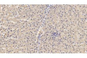 Detection of GPC3 in Human Liver Tissue using Monoclonal Antibody to Glypican 3 (GPC3) (Glypican 3 antibody  (AA 343-559))