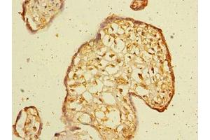 Immunohistochemistry of paraffin-embedded human placenta tissue using ABIN7175798 at dilution of 1:100 (WDR88 antibody  (AA 1-250))