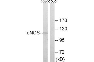 Western blot analysis of extracts from COLO cells, using Enos (Ab-494) antibody. (ENOS antibody  (Thr494))
