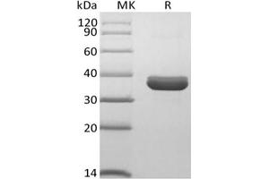 Western Blotting (WB) image for Protein tyrosine Phosphatase, Non-Receptor Type 2 (PTPN2) protein (His tag) (ABIN7319874) (PTPN2 Protein (His tag))