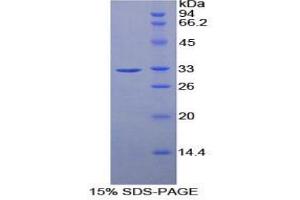SDS-PAGE analysis of Mouse Ribonuclease Inhibitor Protein. (RNH1 Protein)