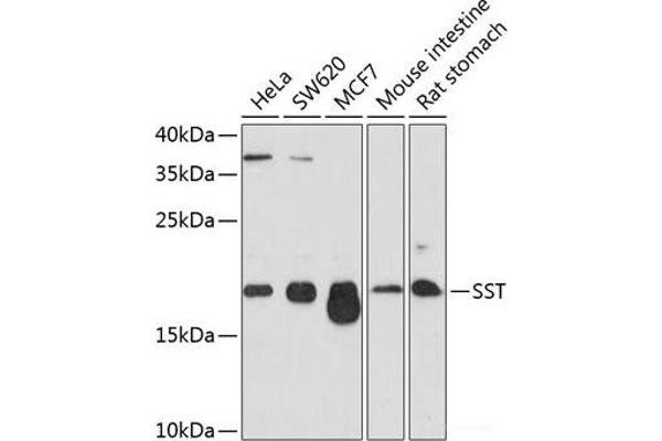 Somatostatin antibody