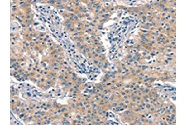 EID3 antibody
