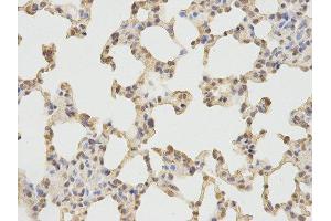 Immunohistochemistry (IHC) image for anti-Protein Kinase, CGMP-Dependent, Type I (PRKG1) antibody (ABIN1874320)