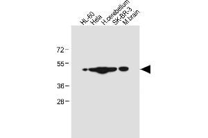 All lanes : Anti-CEPT1 Antibody (N-term) at 1:4000 dilution Lane 1: HL-60 whole cell lysate Lane 2: Hela whole cell lysate Lane 3: Human cerebellum tissue lysate Lane 4: SK-BR-3 whole cell lysate Lane 5: Mouse brain tissue lysate Lysates/proteins at 20 μg per lane. (CEPT1 antibody  (N-Term))