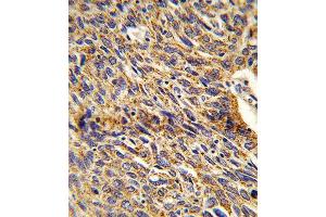 Immunohistochemistry (IHC) image for anti-Enoyl-CoA Delta Isomerase 1 (ECI1) antibody (ABIN3003901) (DCI antibody)