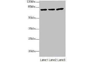 Western blot All lanes: KBTBD7 antibody at 1. (KBTBD7 antibody  (AA 475-684))