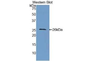 Western blot analysis of the recombinant protein. (ICAM4 antibody  (AA 32-226))