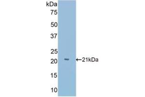 Detection of Recombinant Slit1, Mouse using Polyclonal Antibody to Slit Homolog 1 (Slit1) (SLIT1 antibody  (AA 603-773))