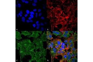 Immunocytochemistry/Immunofluorescence analysis using Mouse Anti-GluN2A/NR2A Monoclonal Antibody, Clone S327A-38 . (NMDAR2A antibody  (AA 75-325) (FITC))
