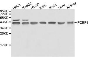 Western blot analysis of extracts of various cell lines, using PCBP1 antibody. (PCBP1 antibody)