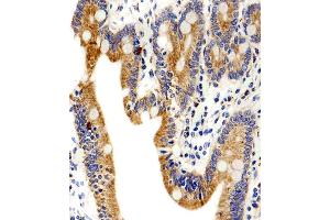 Immunohistochemical analysis of paraffin-embedded H. (ADRA1D antibody  (N-Term))