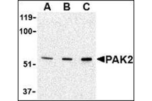 Western blot analysis of PAK2 in Jurkat lysate with this product at (A) 0. (PAK2 antibody  (N-Term))