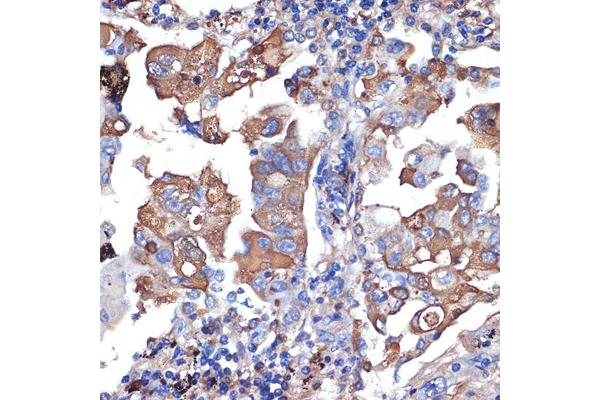 VPS11 antibody