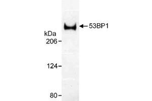 Western blot analysis of human TP53BP1 using TP53BP1 polyclonal antibody .