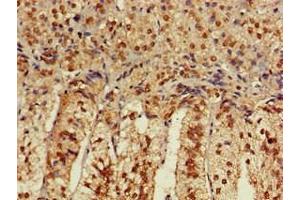 CACNB4 antibody  (AA 1-217)