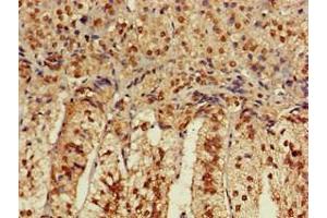 Immunohistochemistry of paraffin-embedded human adrenal gland tissue using ABIN7175600 at dilution of 1:100 (CACNB4 antibody  (AA 1-217))