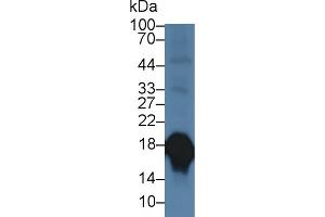 Detection of SOD1 in Porcine Cerebrum lysate using Polyclonal Antibody to Superoxide Dismutase 1 (SOD1) (SOD1 antibody  (AA 2-153))