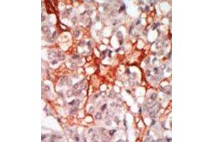 Image no. 1 for anti-Megakaryocyte-Associated tyrosine Kinase (MATK) (N-Term) antibody (ABIN359988) (MATK antibody  (N-Term))