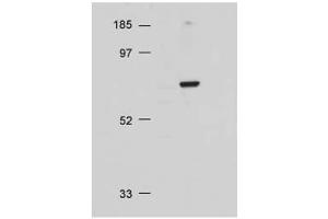 Western Blot of Rabbit Anti-AKT antibody. (AKT1 antibody  (C-Term))