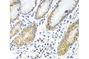 Immunohistochemistry of paraffin-embedded Human stomach using ATAD3A Polyclonal Antibody at dilution of 1:100 (40x lens). (ATAD3A antibody)