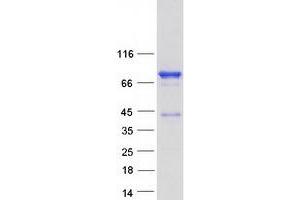 Validation with Western Blot