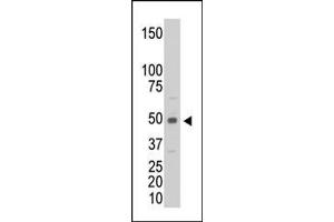 The anti-CKM Pab (ABIN391096 and ABIN2841235) is used in Western blot to detect CKM in C6 cell lysate. (CKM antibody  (C-Term))