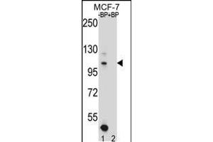 Western blot analysis of HIPK1 Antibody Pab pre-incubated without(lane 1) and with(lane 2) blocking peptide in MCF-7 cell line lysate. (HIPK1 antibody  (C-Term))