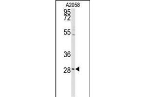 Western blot analysis of anti-PRKCDBP Antibody (Center) (ABIN392215 and ABIN2841911) in  cell line lysates (35 μg/lane). (PRKCDBP antibody  (AA 113-144))