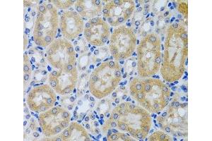 Immunohistochemistry of paraffin-embedded Mouse kidney using ACP1 Polyclonal Antibody at dilution of 1:100 (40x lens). (ACP1 antibody)