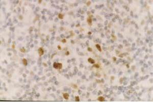 Staining of CD55 on formalin fixed paraffin embedded lymphnode (heat treated with citrate buffer retrieval) using SM1141Pdiluted1/100