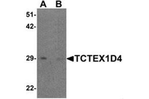 Western blot analysis of TCTEX1D4 in mouse liver tissue lysate with TCTEX1D4 antibody at 1 ug/mL in (A) the absence and (B) the presence of blocking peptide. (TCTEX1D4 antibody  (N-Term))
