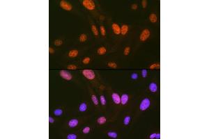 Immunofluorescence analysis of U-2 OS cells using HIPK2 Rabbit mAb (ABIN7267779) at dilution of 1:100 (40x lens). (HIPK2 antibody)