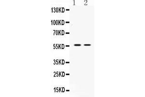 Western blot analysis of ANGPTL2 expression in rat stomach extract ( Lane 1) and mouse ovary extract ( Lane 2). (ANGPTL2 antibody  (Middle Region))
