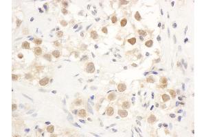 Immunohistochemistry (IHC) image for anti-Checkpoint Kinase 1 (CHEK1) (AA 250-300) antibody (ABIN7453553)