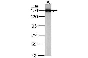 WB Image Sample (30 ug of whole cell lysate) A: Raji 7. (MAGI2 antibody  (C-Term))