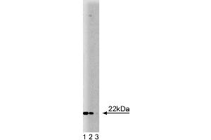 Western blot analysis of Ninjurin on HepG2 lysate. (NINJ1 antibody  (AA 1-152))