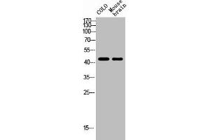Western Blot analysis of MOUSE-BRAIN COLO cells using NK-1R Polyclonal Antibody (TACR1 antibody  (Internal Region))