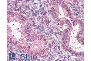 ABIN190811 (5µg/ml) staining of paraffin embedded Human Uterus. (CTDSP1 antibody  (Internal Region))