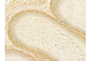 ABIN6259995 and ABIN6279131 at 1/100 staining human testicular cancer by IHC-P.
