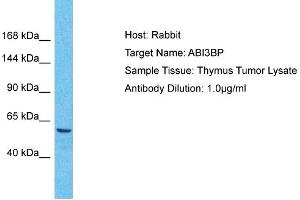 Host: Rabbit Target Name: ABI3BP Sample Tissue: Human Thymus Tumor Antibody Dilution: 1ug/ml (ABI3BP antibody  (C-Term))