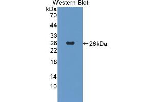 Detection of Recombinant SOCS2, Human using Polyclonal Antibody to Suppressors Of Cytokine Signaling 2 (SOCS2) (SOCS2 antibody  (AA 1-198))