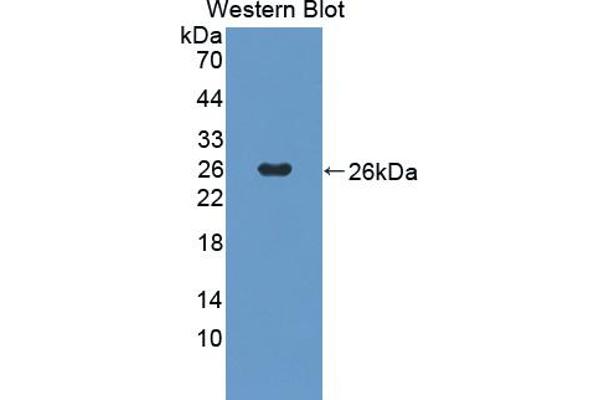 SOCS2 antibody  (AA 1-198)